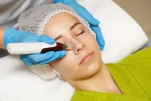 Dermapen microneedling